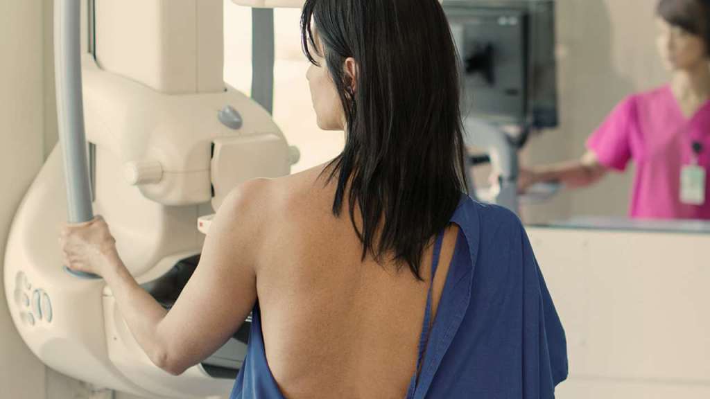 7 cosas que puede hacer para reducir el riesgo de cáncer de mama