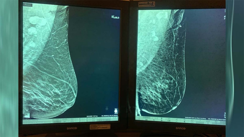 Prevenir, curar y revertir enfermedades de forma&nbsp;natural