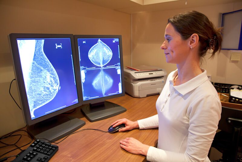 7 formas de reducir el riesgo de cáncer de mama