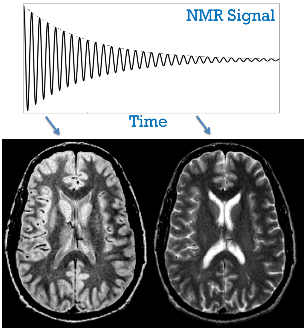 La ciencia de las imágenes médicas: imágenes por resonancia magnética&nbsp;(IRM)